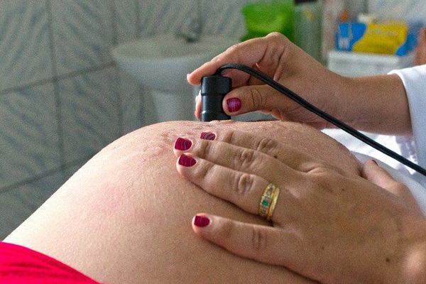 Meninas abaixo de 14 anos deram à luz a 5.652 bebês no RN entre 2010 e 2021