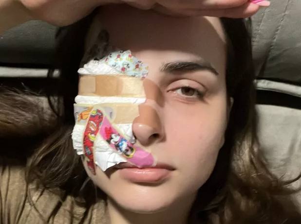 Influencer arranca pedaço da córnea ao coçar os olhos com as unhas grandes: “Pior noite”
