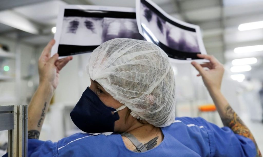 RN está acima da média de cura no Brasil da Tuberculose