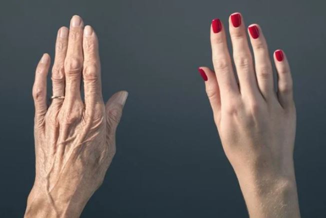 Cientistas conseguem rejuvenescer pele de mulher em 30 anos