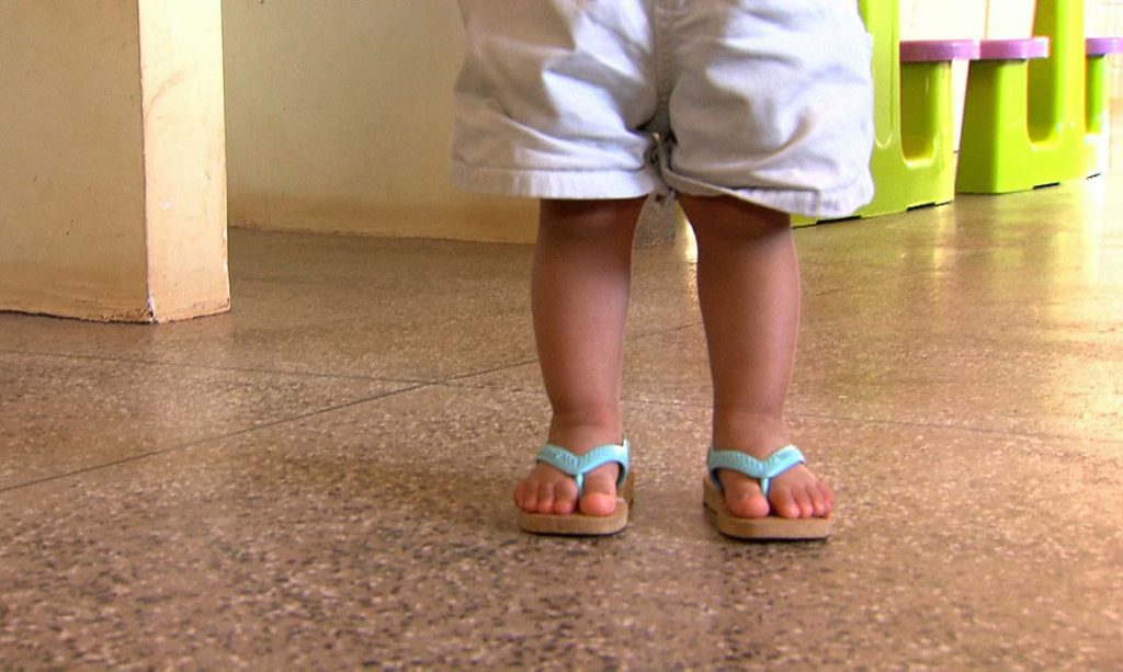 Hepatite desconhecida: Brasil tem 28 casos suspeitos da doença em crianças