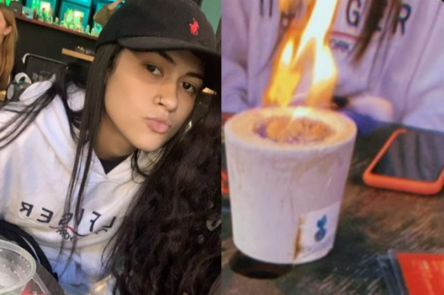 Adolescente tem rosto queimado após acidente com minilareira em bar