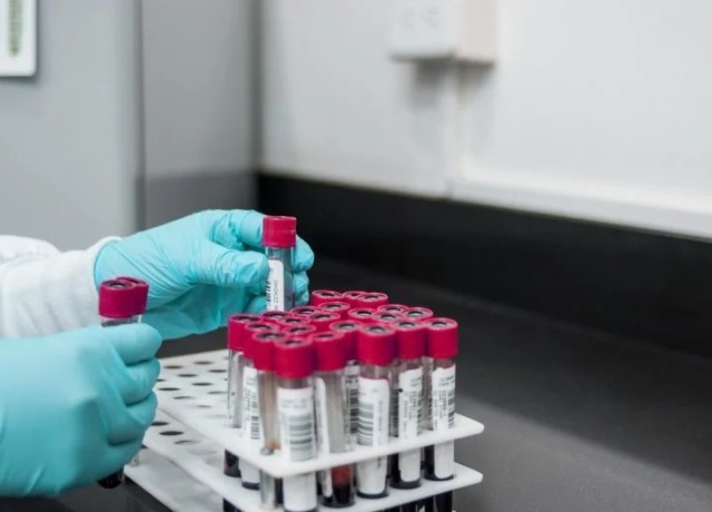 Brasil monitora 16 casos suspeitos de hepatite misteriosa
