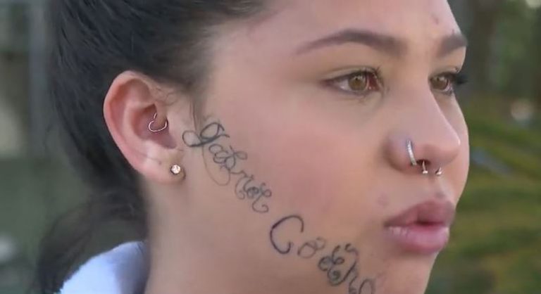 Jovem passará por procedimento para retirar tatuagens feitas pelo ex