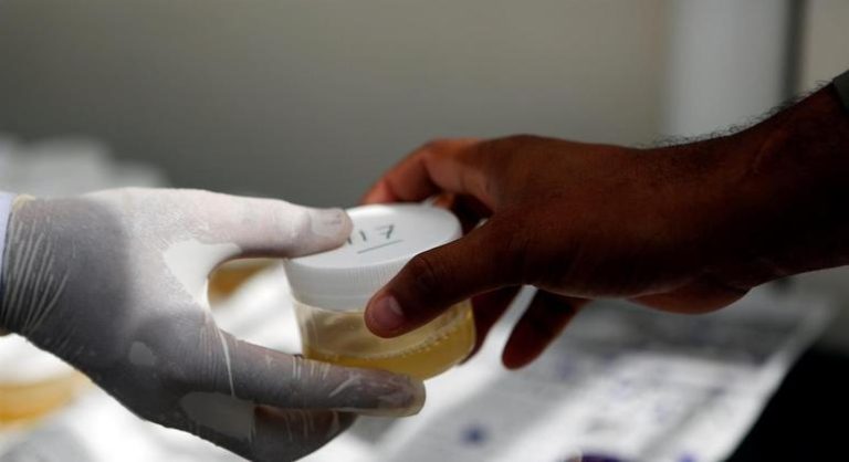 Covid: brasileiros criam teste de urina mais preciso que exame de sangue na detecção de anticorpos