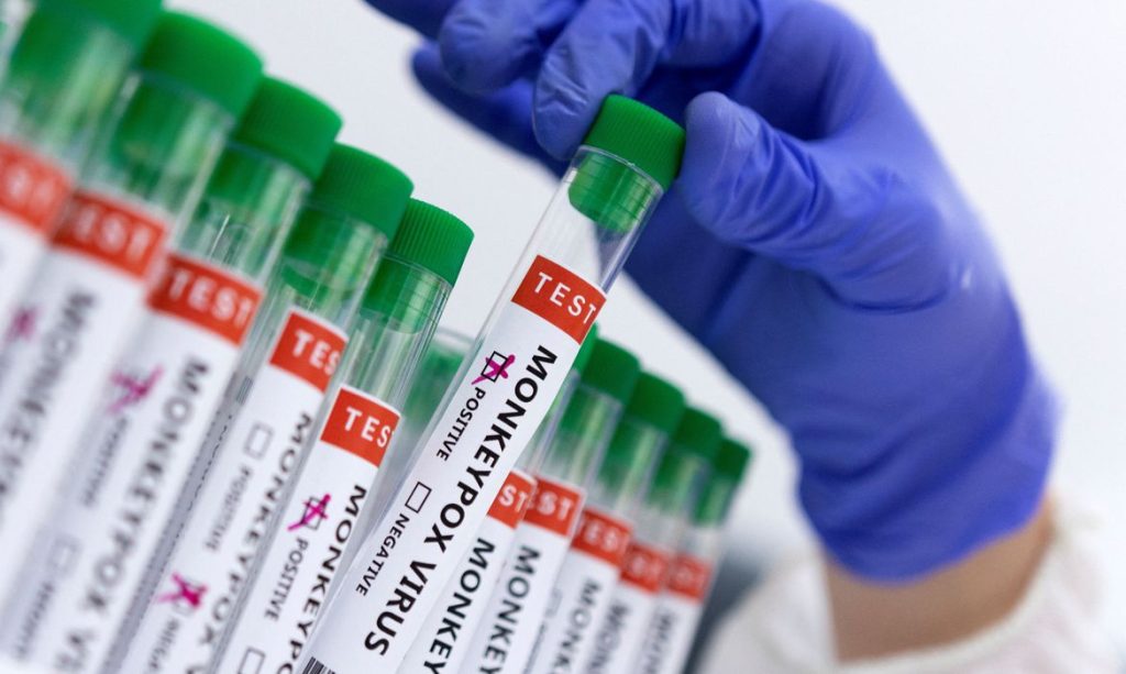 Fiocruz produz insumos para diagnóstico da varíola dos macacos