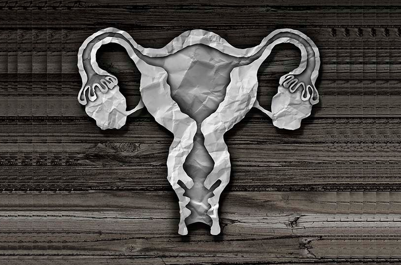 Homem passa 20 anos menstruando e descobre que tem útero e ovários