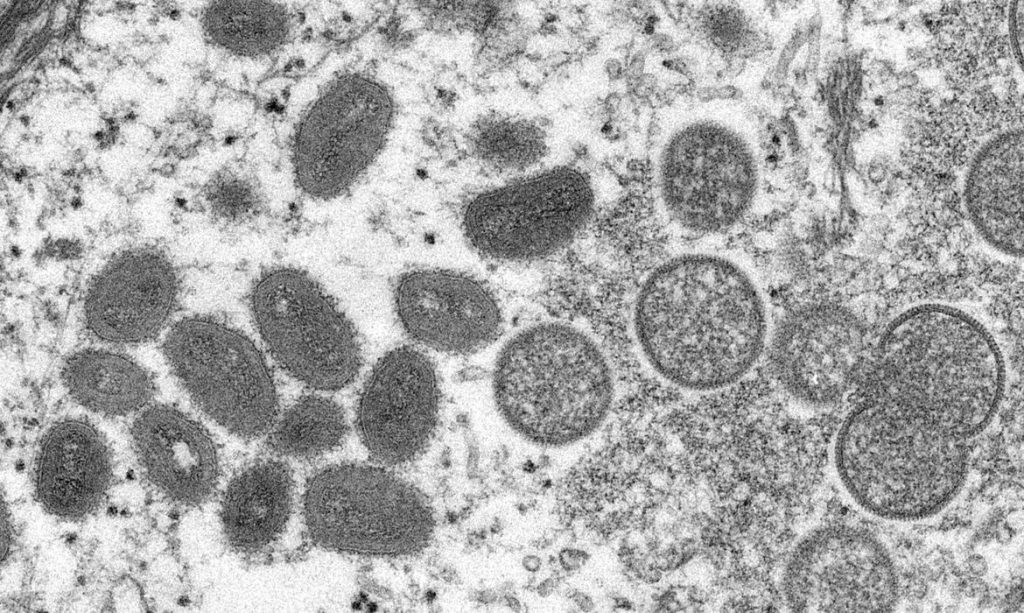 Número de casos de Varíola dos macacos preocupa a OMS