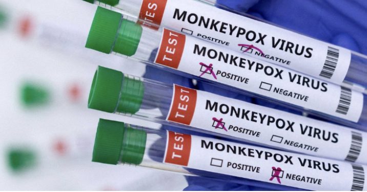 Mossoró tem primeiro caso suspeito de varíola dos macacos