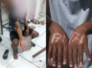 “Vi a morte”, diz jovem espancado e marcado a ferro por patrão na Bahia
