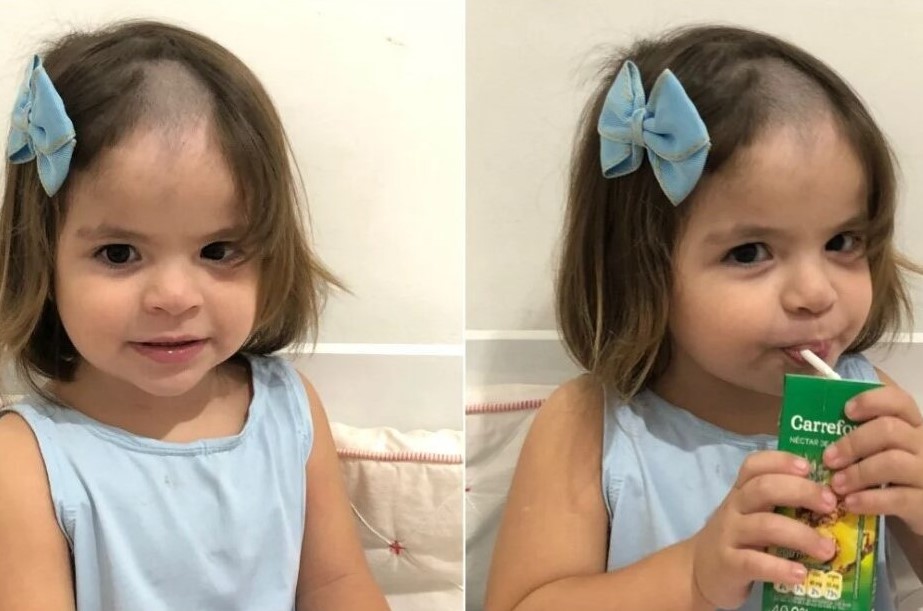 Menina de 2 anos de Natal raspa o cabelo escondido e vídeo que mostra ‘resultado’ viraliza