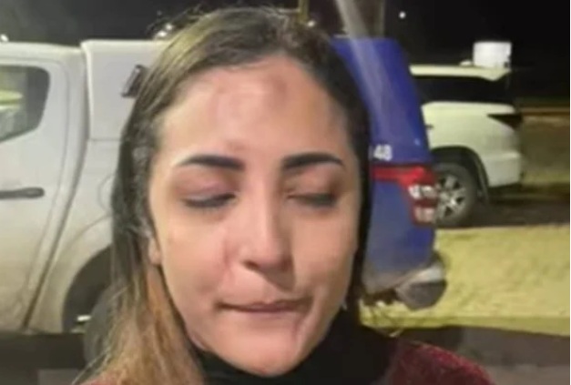 Vocalista de banda é espancada por casal antes de show