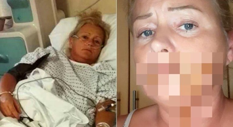 Mulher passa três dias no hospital após chihuahua defecar no rosto dela
