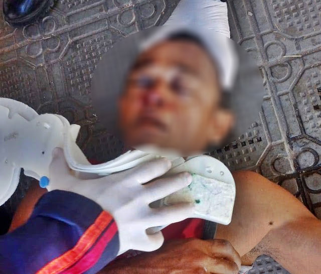 Homem residente em Mossoró é morto por espancamento na cidade de Assu no Rio Grande do Norte.