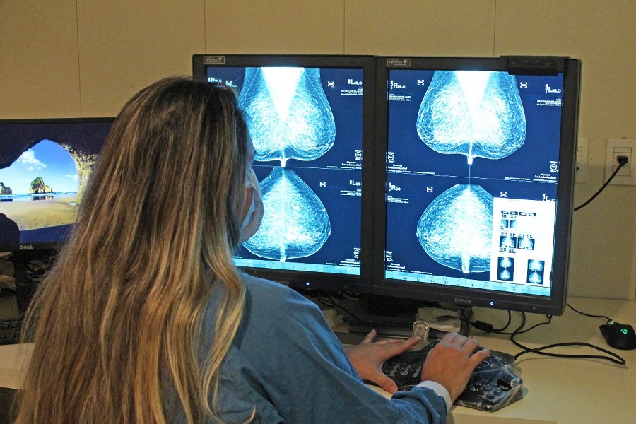 Pesquisa aponta que pacientes da rede pública descobrem câncer de mama em estágios mais avançados