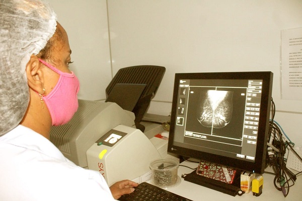 Número de mamografias realizadas pelo SUS tem redução no Estado