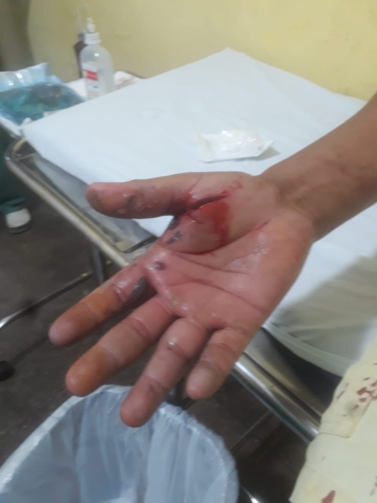 Bope emite nota e diz que não realizava nenhum treinamento quando homem encontrou artefato explosivo