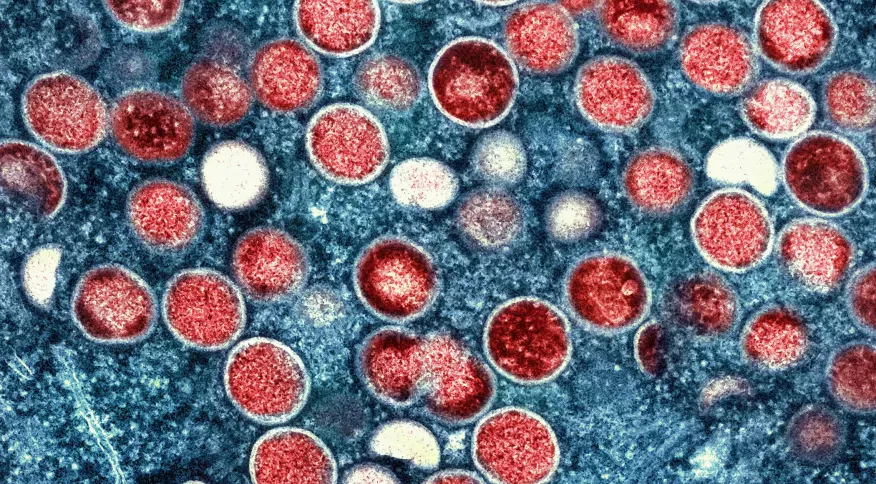 OMS confirma mudança de nome da varíola dos macacos para “Mpox”