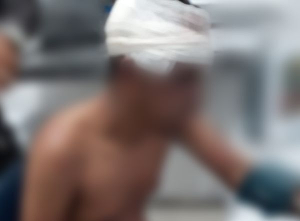 Polícia População espanca foragido por roubo e ele vai para o hospital com suspeita de traumatismo na Grande Natal