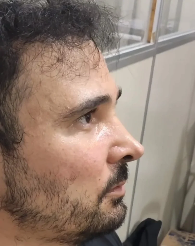 Defesa de suspeito de matar psicóloga em Assú aguarda laudos psiquiátricos para tentar soltura