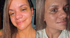 Após sofrer mais de 60 Socos, Estudante Celebra Reconstrução Facial e Retomada da Identidade